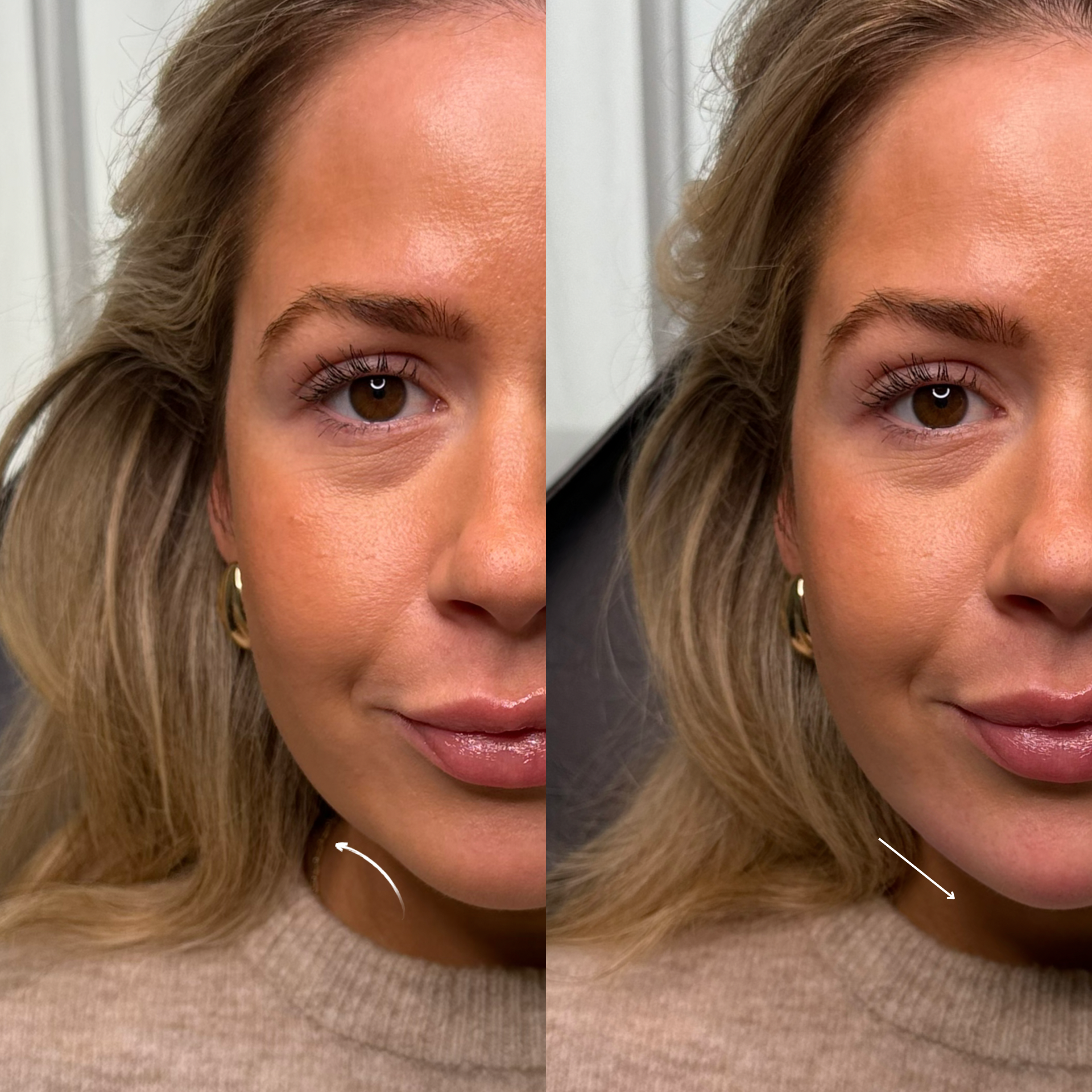 Skin Booster