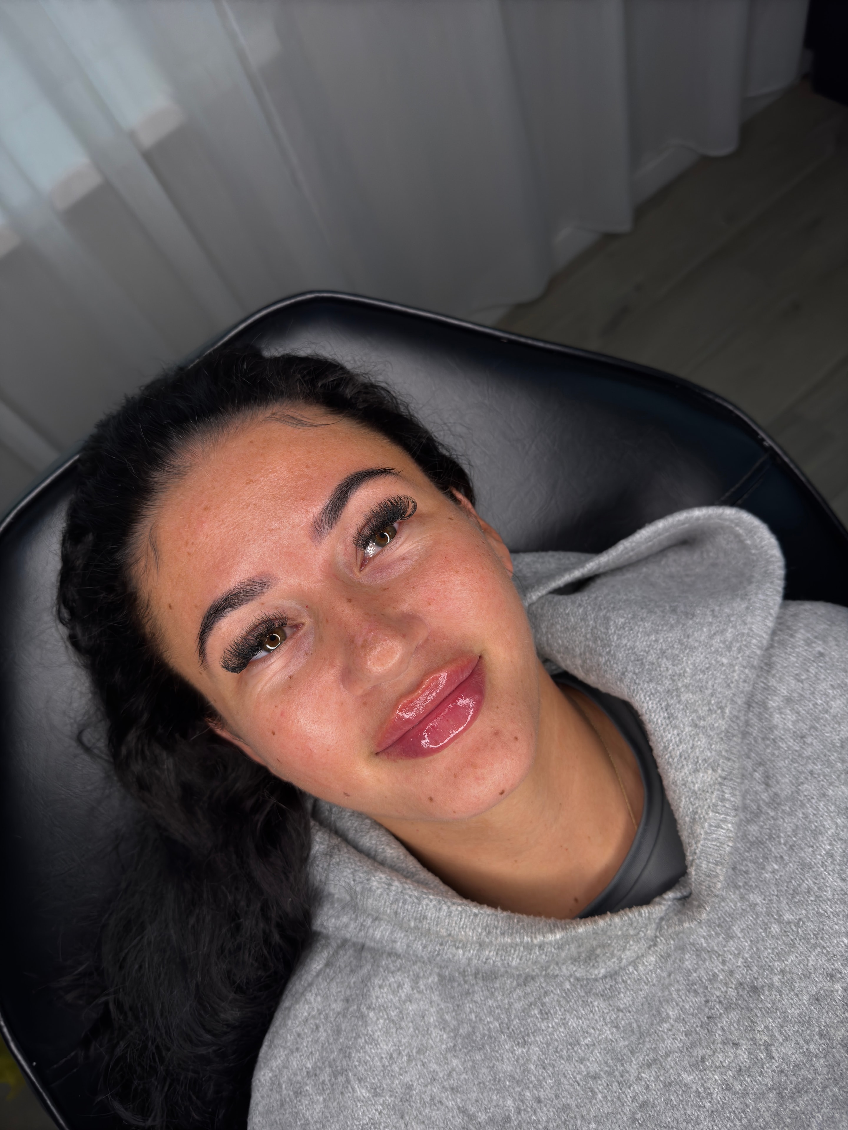 Lip Filler